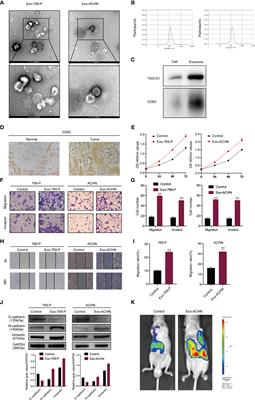 Exosomal Circsafb2 Reshaping Tumor Environment to Promote Renal Cell Carcinoma Progression by Mediating M2 Macrophage Polarization